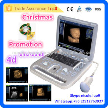 Promotion de Noël! CU18-I New Advanced 4D Portable Ultrasound Machine Price